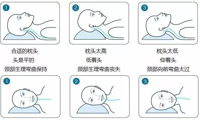 脊柱側(cè)凸預防